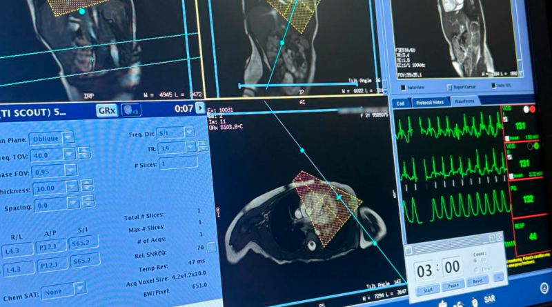 Hospital Márcio Cunha realiza a primeira ressonância cardíaca pediátrica do Vale do Aço